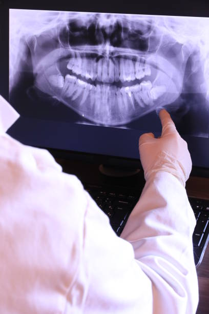 Best Emergency Gum Treatment in Burlington, KY